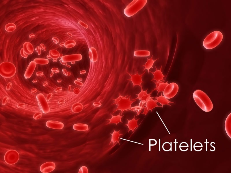 Platelet count high