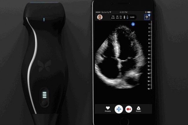This iPhone-based ultrasound machine can detect cancer ...